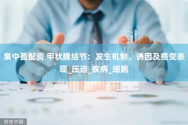 集中盈配资 甲状腺结节：发生机制、诱因及癌变表现_压迫_疾病_细胞